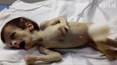 [영상] 시리아 내전이 낳은 처참한 희생자