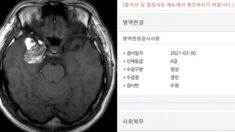 “뇌종양 수술했는데 4급 공익 판정을 받았습니다”