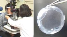 연구진들이 개발한 ‘돼지껍데기 렌즈’, 시각장애인 20명 시력 완전히 회복했다