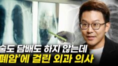 술도 담배도 하지 않는데 ‘폐암’에 걸린 의사