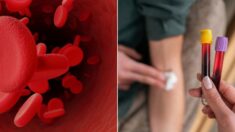 전세계에서 ‘단 1명뿐’인 혈액형 발견…수혈은 어떻게 하나